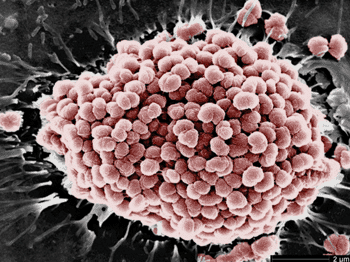 Imagen: La infección de células epiteliales humanas por Neisseria gonorrhoeae (Fotografía cortesía de la Dra. Magdalena So).